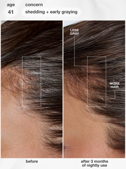 K18 : FutureIQ™ – Sérum Biomimétique Longévité Capillaire