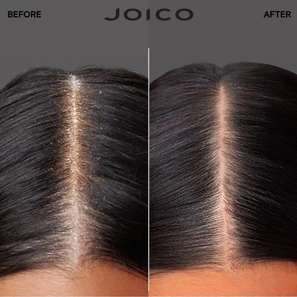 Joico : Trio Scalp Vitality - Revitalisez et équilibrez