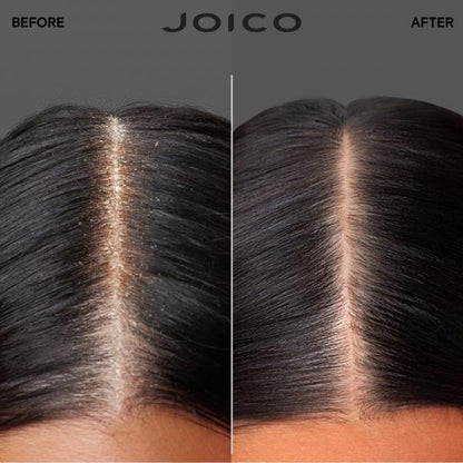Joico : Trio Scalp Vitality - Revitalisez et équilibrez